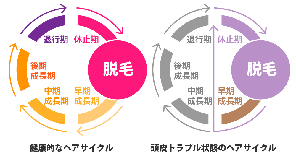 健康なヘアサイクルと頭皮トラブル状態のヘアサイクル